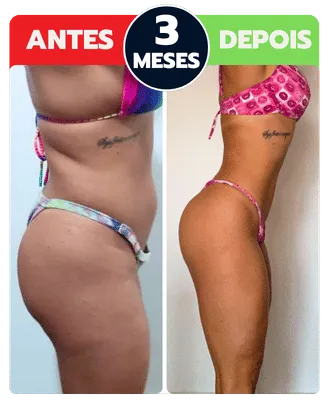 Antes e depois: 3 meses