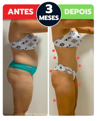 Antes e depois: 3 meses